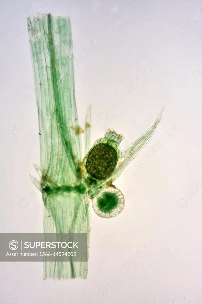 Chara vulgaris (common stonewort) sexual organs. Optical microscope X40.