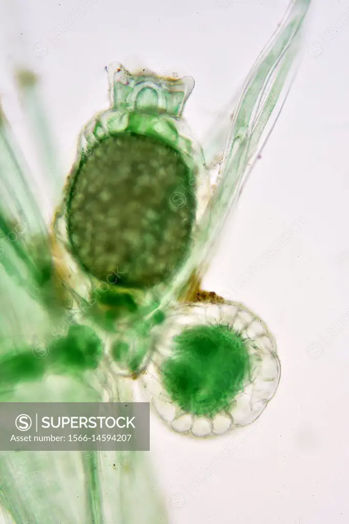 Chara vulgaris (common stonewort) sexual organs. Optical microscope X100.