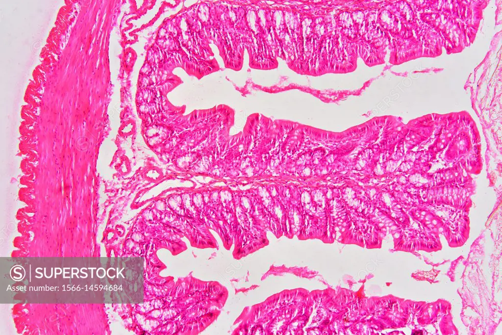 Rectum (large intestine) showing adventitia, muscular layer, lamina propria, submucosa, mucosa, epithelium, villi and intestinal glands. Optical micro...