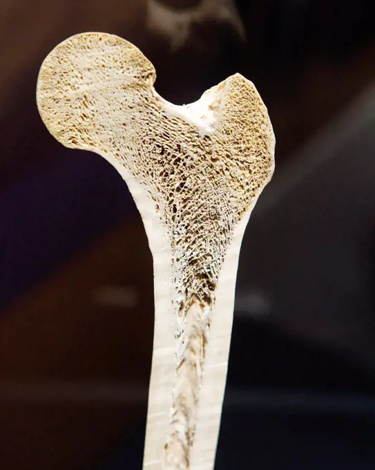 Cross section view of a human femur bone showing trabeculae