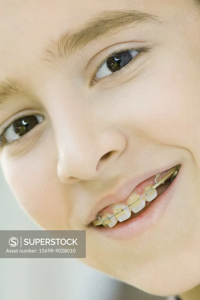 Boy with braces smiling at camera, portrait