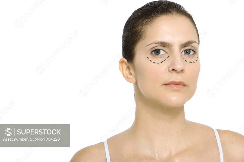 Woman with plastic surgery markings under eyes, looking at camera