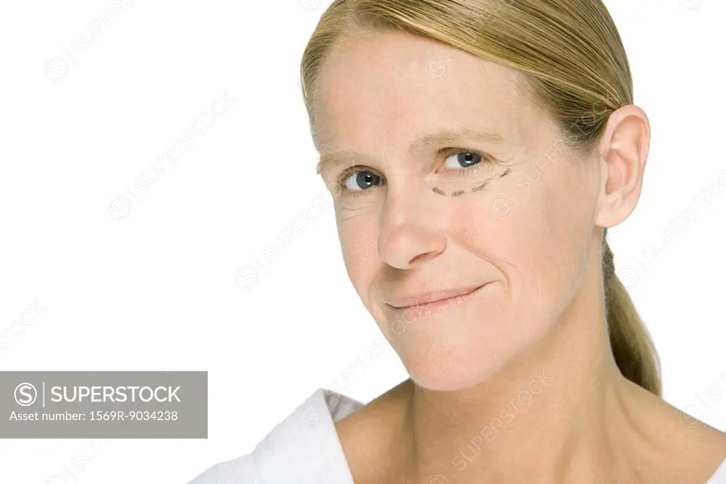 Woman with plastic surgery markings under one eye, smiling at camera
