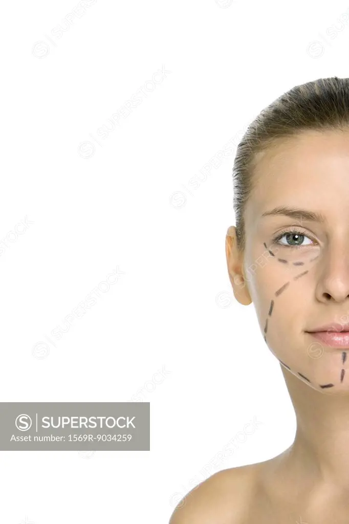 Woman with plastic surgery markings on face, looking at camera, cropped
