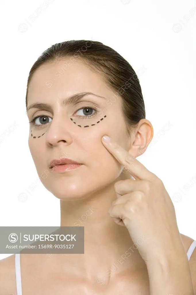 Woman pointing at plastic surgery markings on cheek, looking at camera