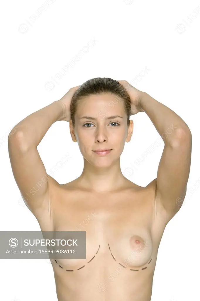 Nude woman with plastic surgery markings under breasts, hands on head, smiling at camera