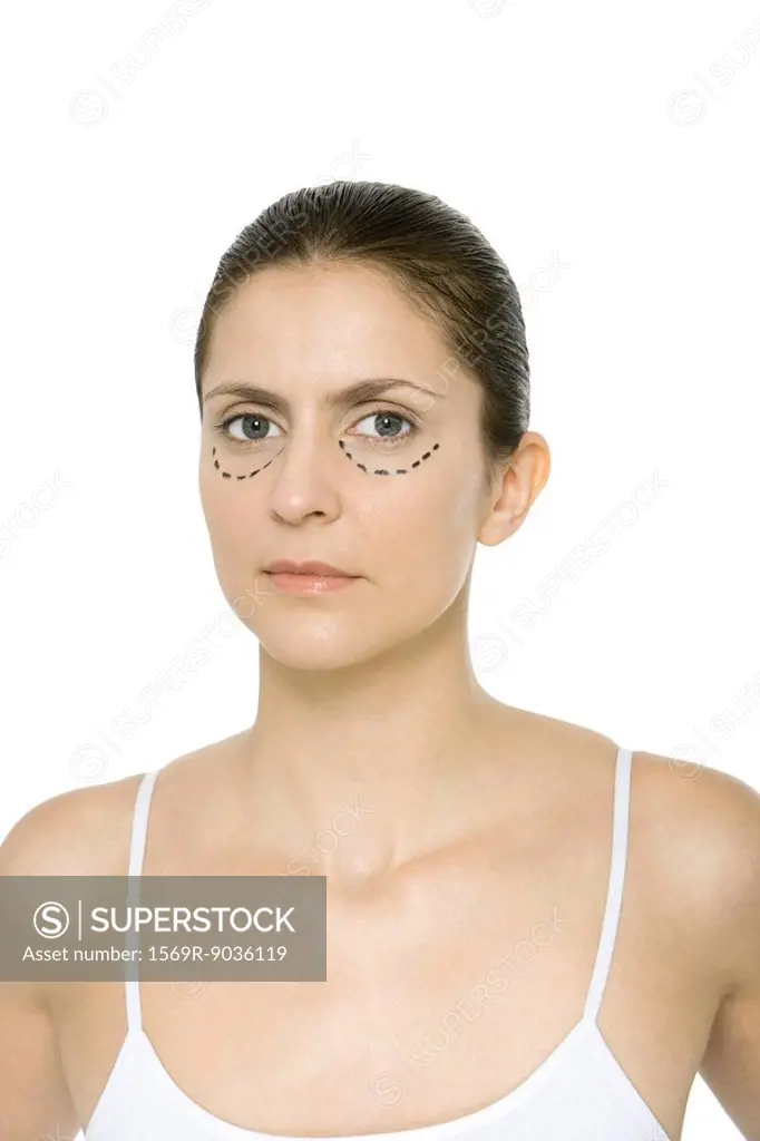 Woman with plastic surgery markings under her eyes, portrait
