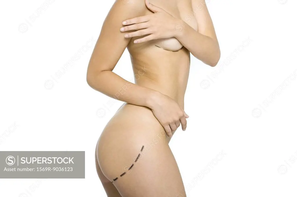 Nude woman with plastic surgery markings on body, covering breasts
