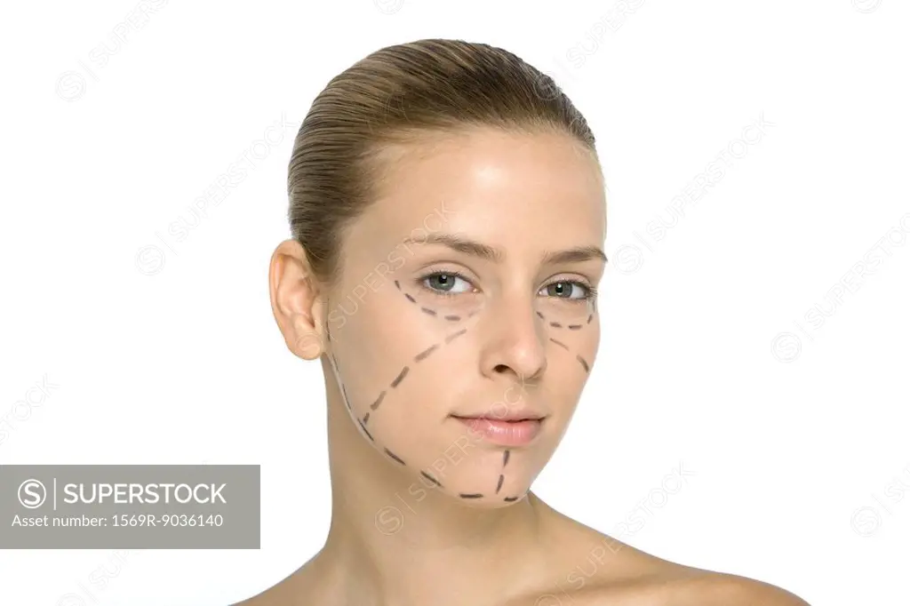 Young woman with plastic surgery markings on face, looking at camera