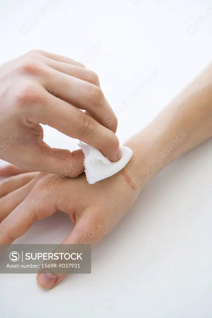 Person holding gauze against wounded hand, cropped view