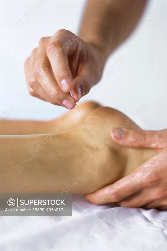 Acupuncture needle being inserted in patient´s ankle