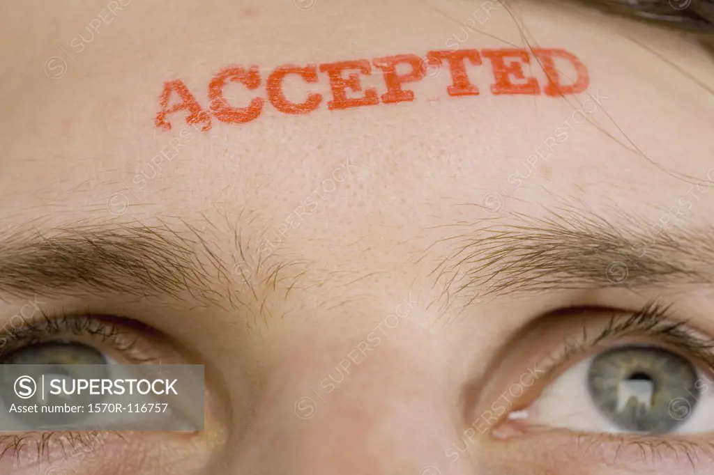 A man with 'Accepted' stamped on his forehead