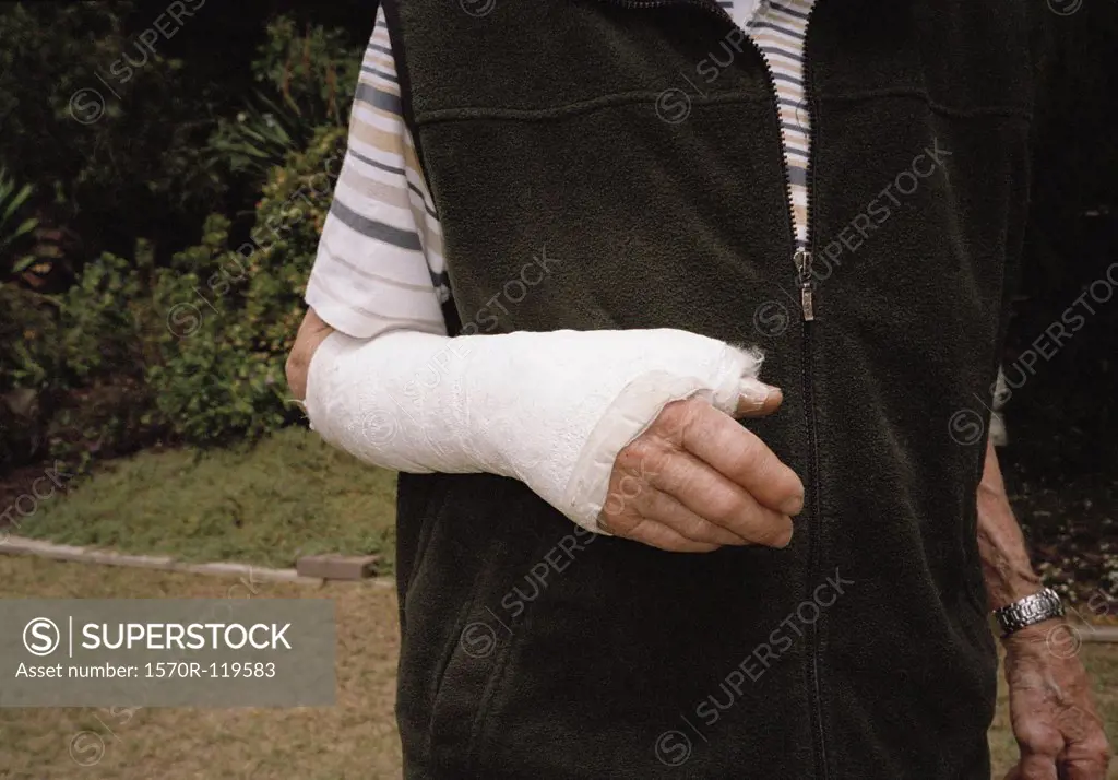 Elderly man with her arm in a plaster cast