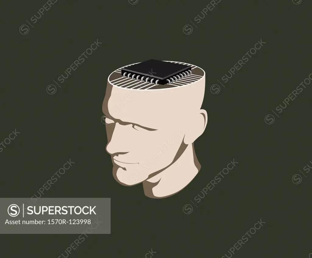 A man with a computer chip inside his head