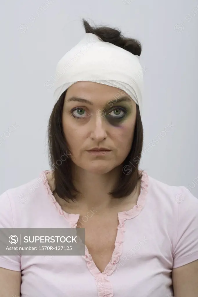 A woman with a black eye and bandaged head