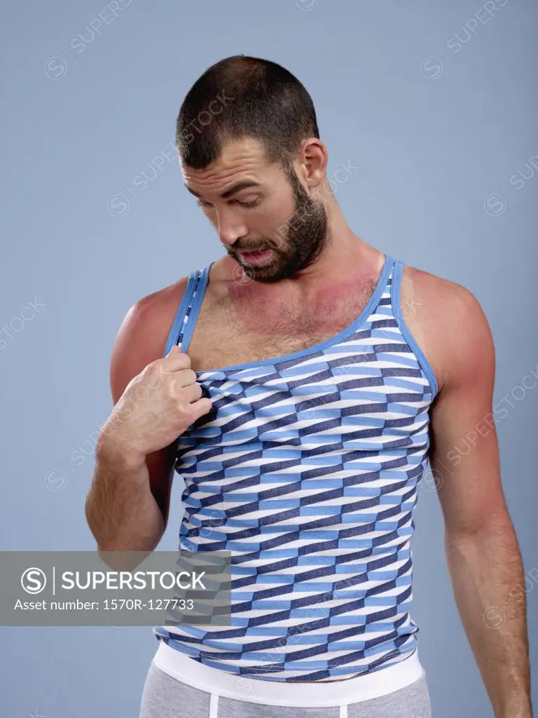 A man looking at his sunburned chest