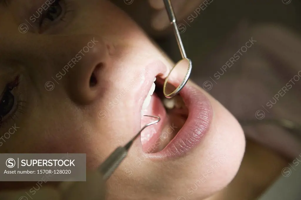 Close-up of a dentist inspecting a woman's mouth