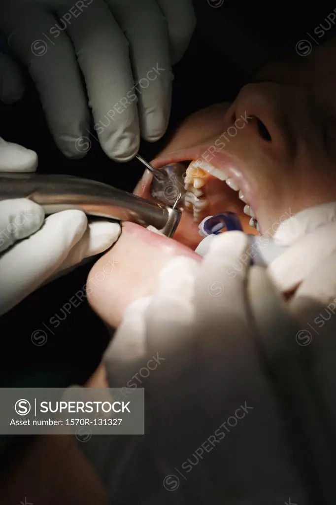 Close-up of a dentist and a dental assistant working on a female patient