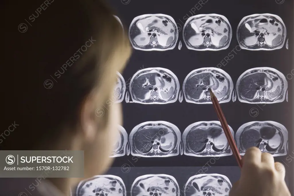 A doctor studying a MRI scan