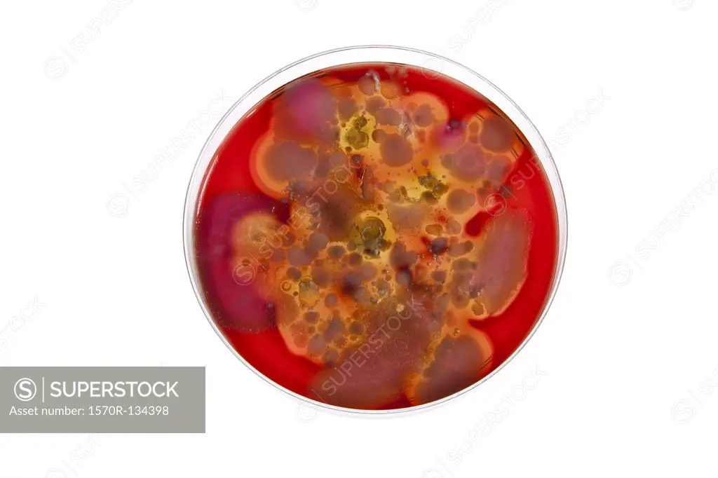 A bacteria culture growing in a Petri dish