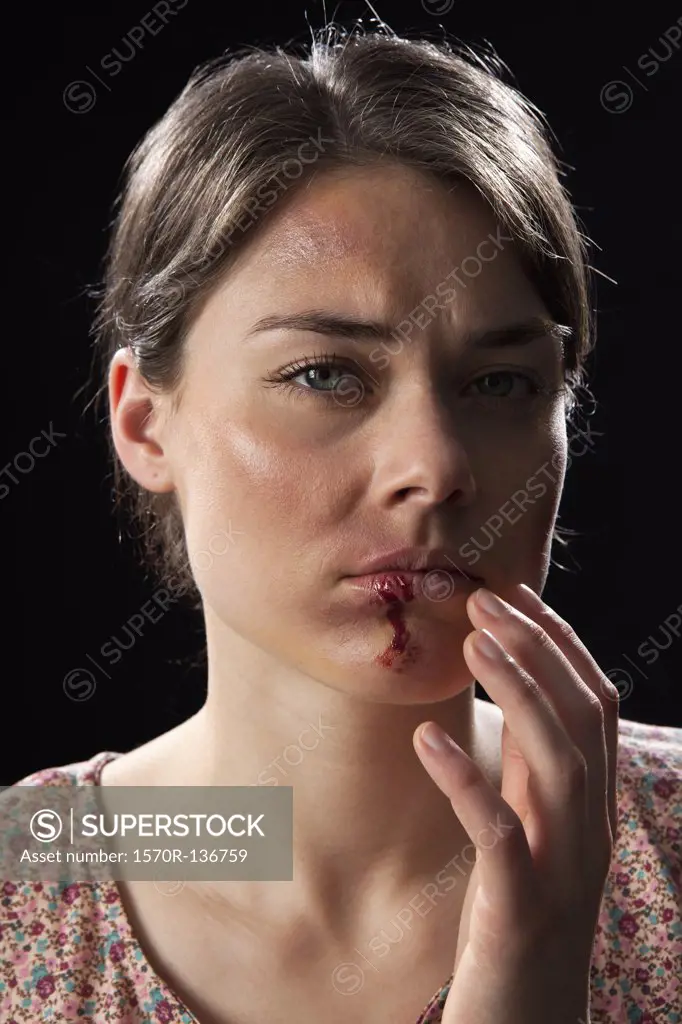 A woman with bruises and bloody lip