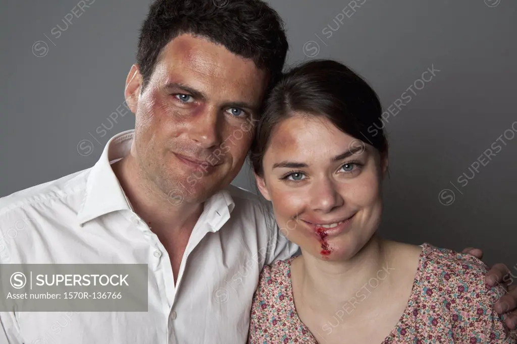 A bruised and beaten couple smiling cheerfully at the camera