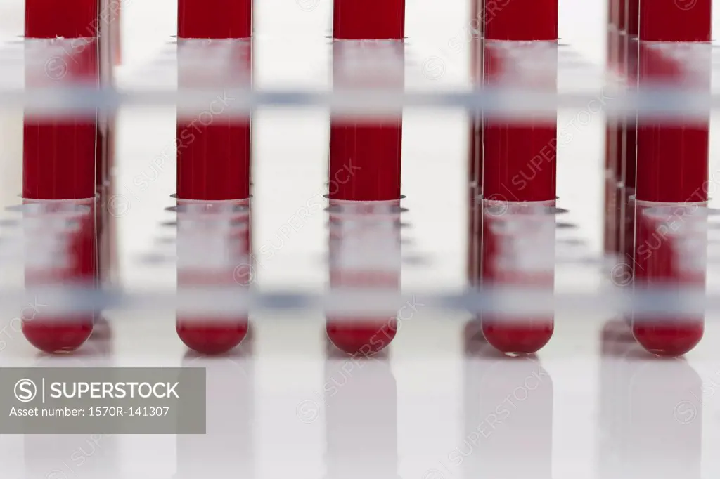 Row of blood samples in test tubes