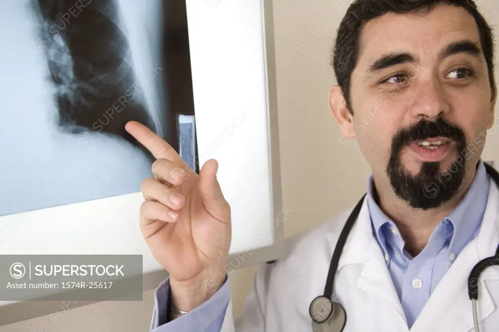 Close-up of a male doctor pointing to an x-ray image