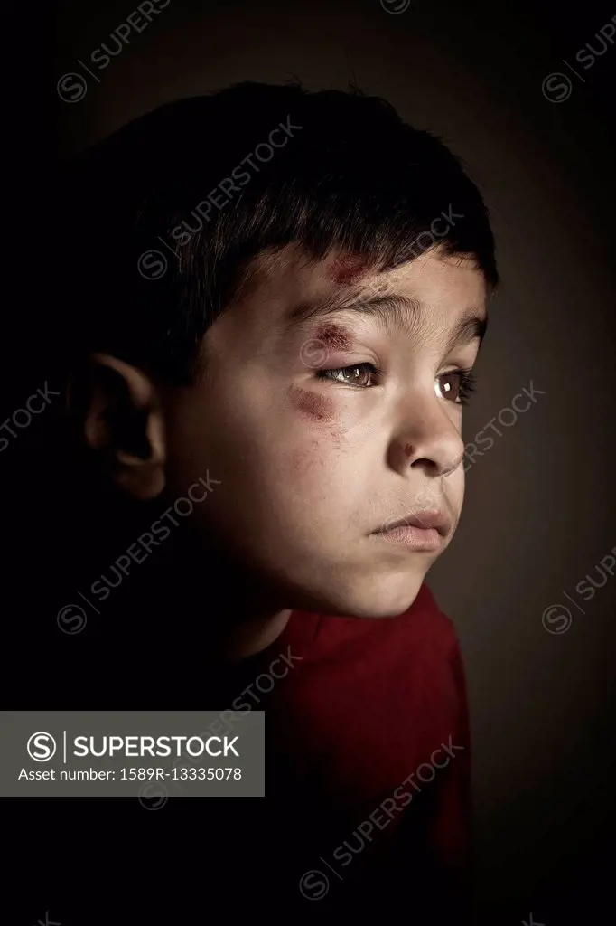 Mixed race boy with scrapes on his face