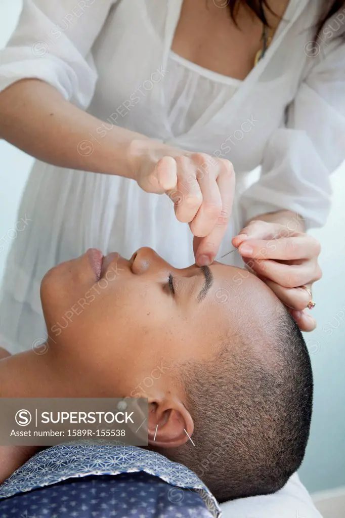 Black woman receiving acupuncture treatments