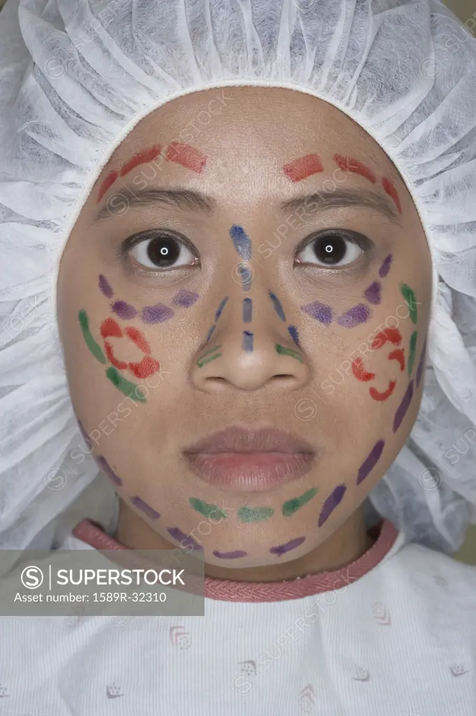 Close up of Asian woman prepped for facelift