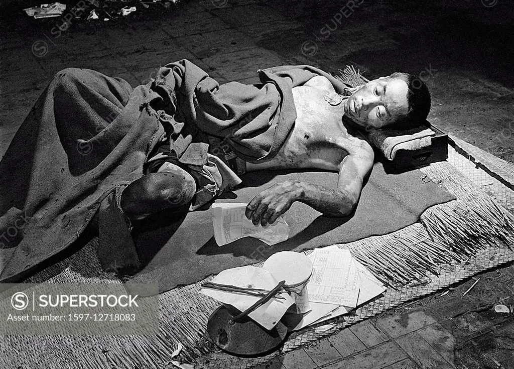 victim in Hiroshima after Atomic Bomb strike in 1945