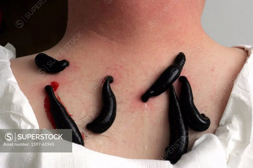 Medicine, Medical Leech, Medicinal leeches, Skin, Blood, Doctor, Neck,  Person, Animal, Animals, Treatment, Therapy, In - SuperStock