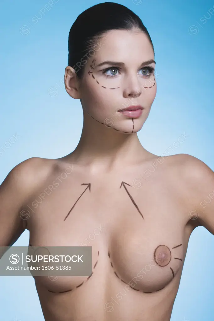 Young woman with presurgical markings on breast and face