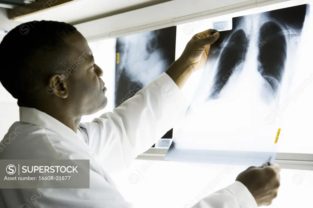 Male doctor looking at chest x-rays