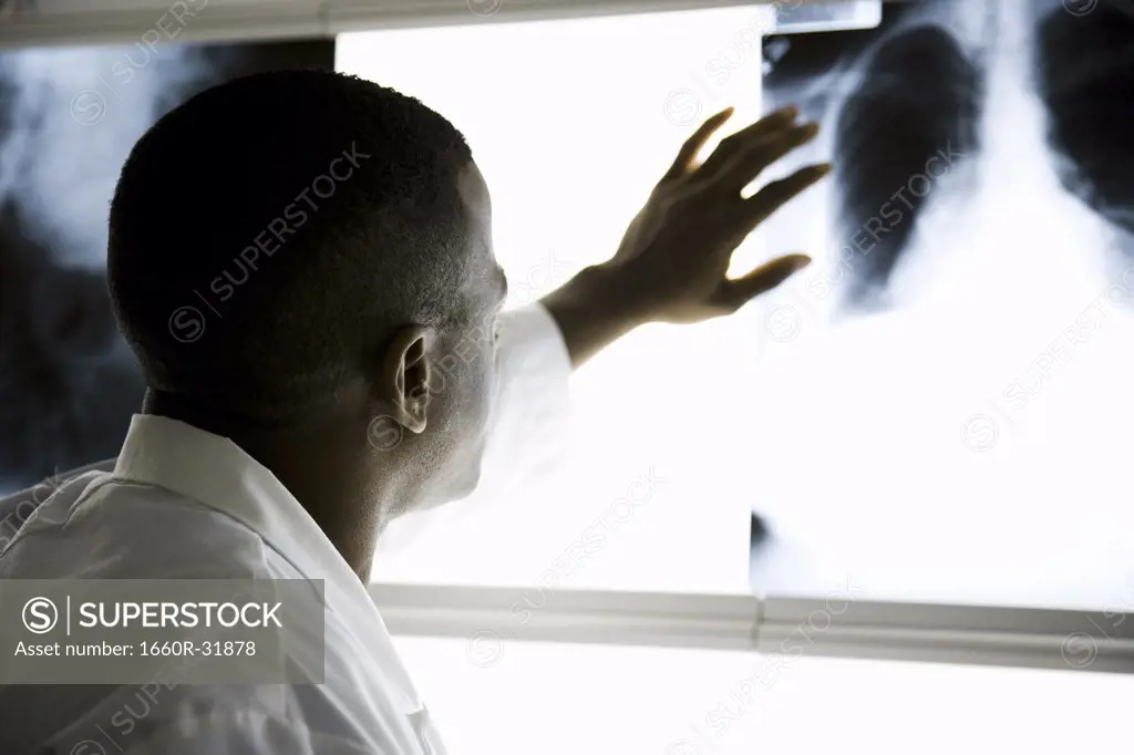 Male doctor looking at chest x-rays