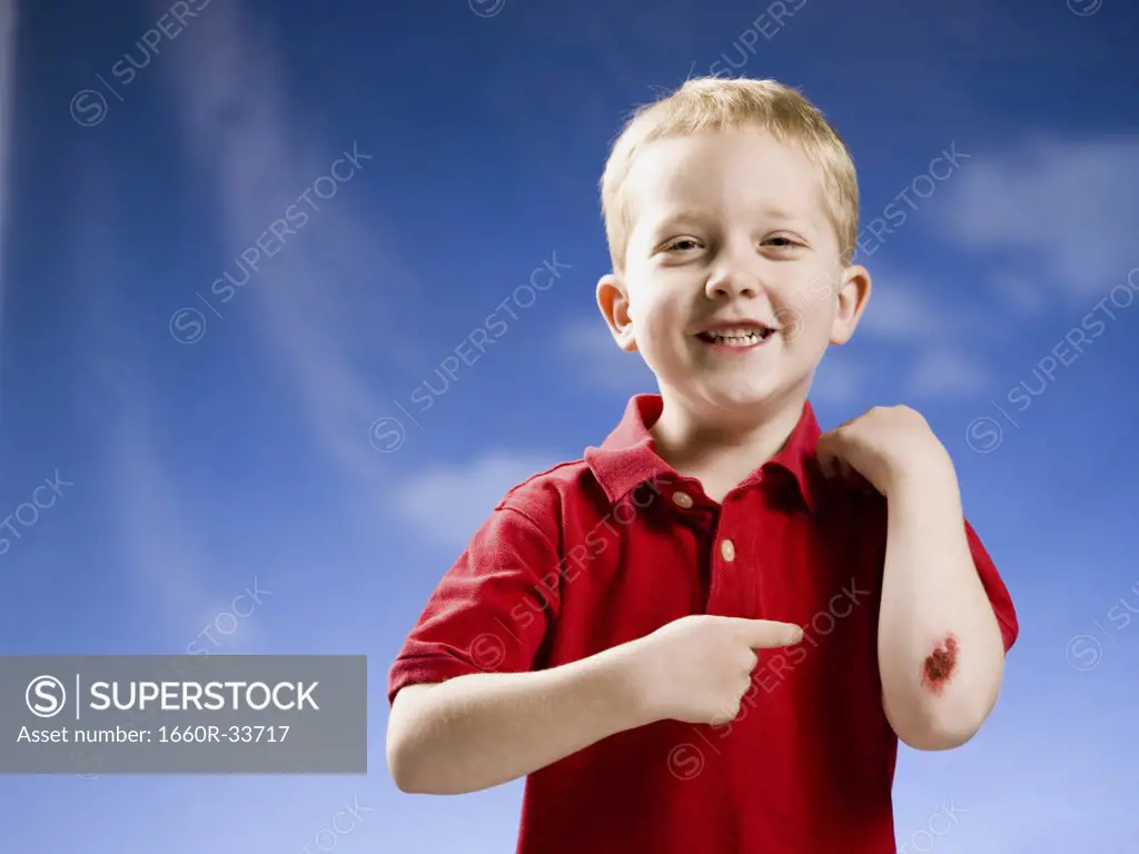 Boy with scraped elbow