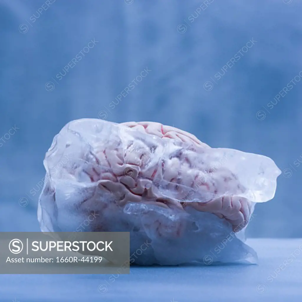 brain freeze