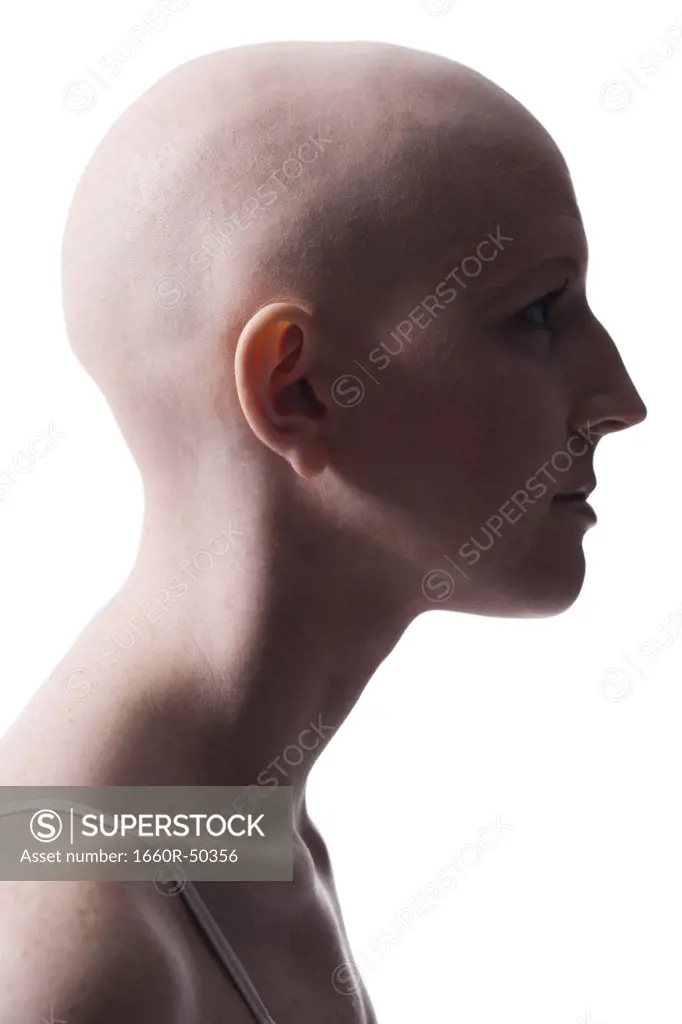 Bald woman