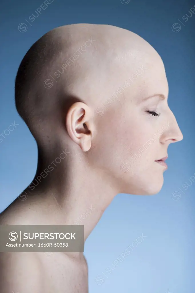 Bald woman