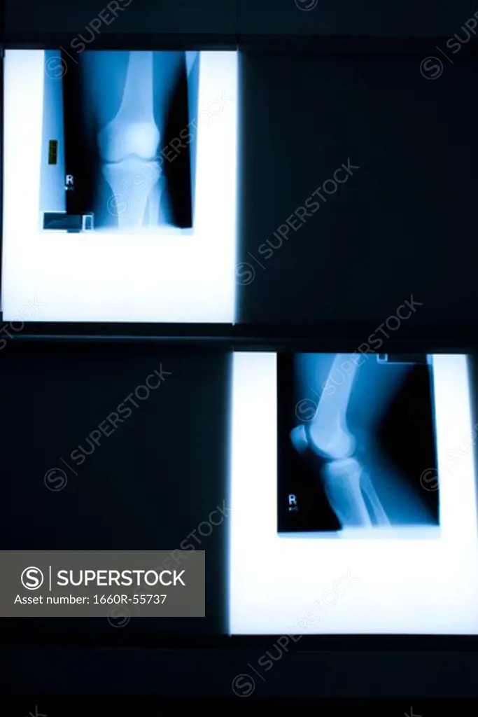 Male hands holding xrays