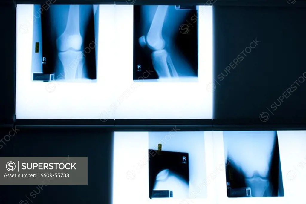 Male hands holding xrays