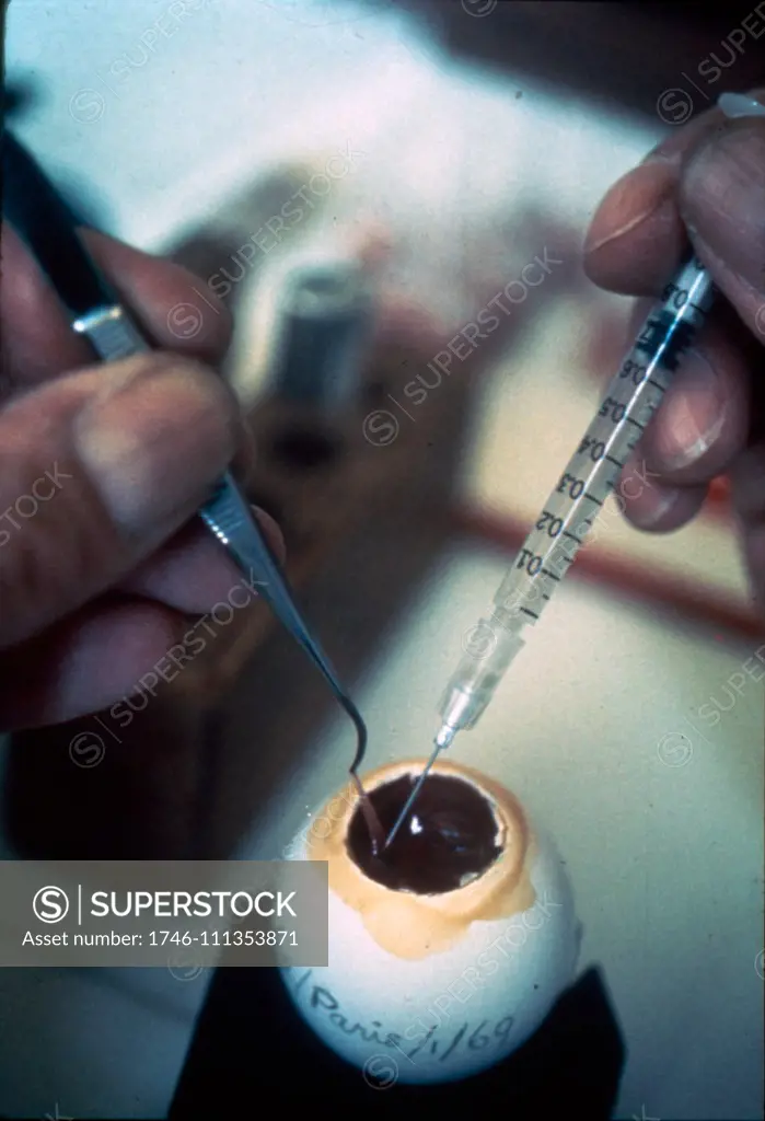 Analysing Influenza virus at a World Health Organisation facility 1980's