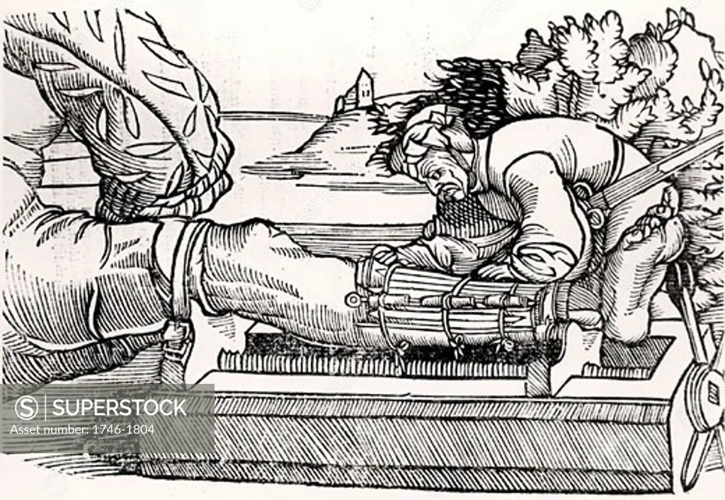 Setting a fractured leg. Woodcut from Veldt Boeck van den Chirugia Scheel-Hans by Hans van Gersdorff (Amsterdam, 1593). A Dutch translation of Gersdorff's book first published in Strasbourg, 1517, and containing woodcuts from the original edition.