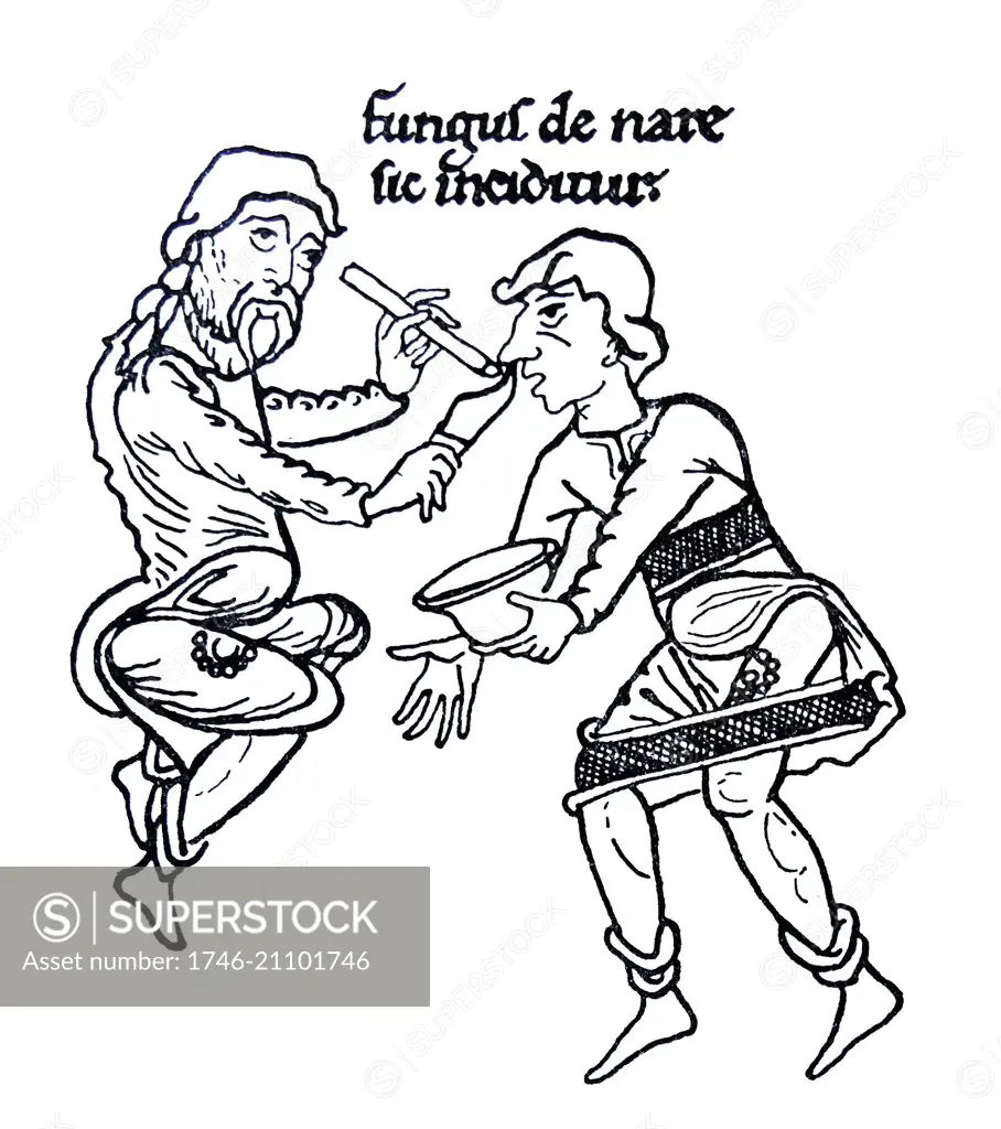 Drawing of the mediaeval treatment of a nasal affliction. The text above is 'Fungus de nase sic inciditur' which translates to 'Thus polypus is cut out of the nose'. Dated 12th Century