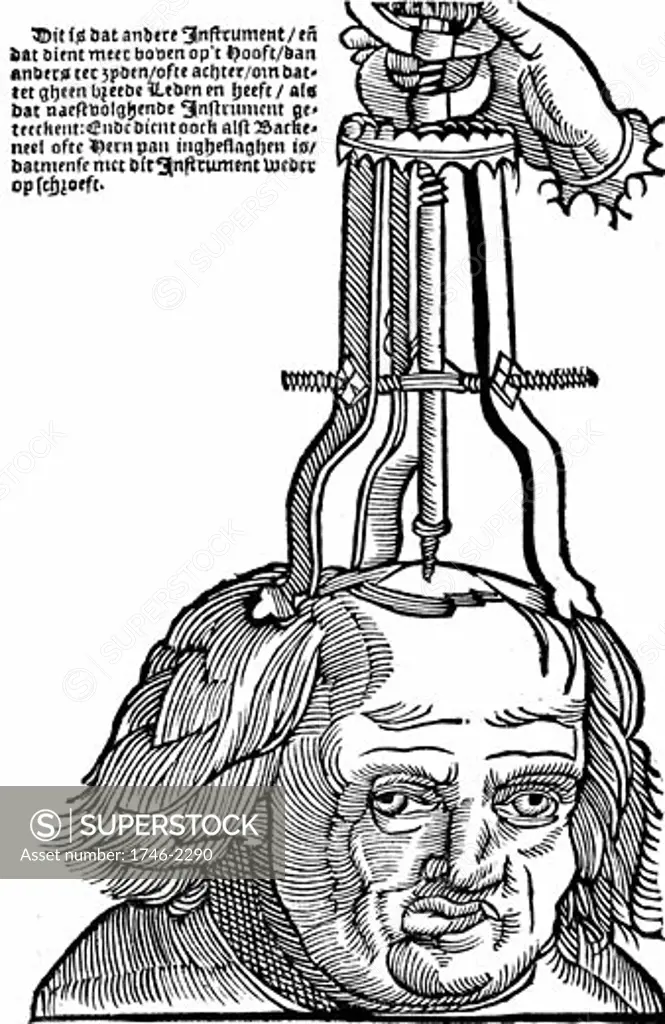 Trephination: Using an elevator to remove piece of bone from the skull. Woodcut from Hans von Gersdorf Veldt Boeck van den Chirugia Scheel-Hans,  Amsterdam 1593. Woodcut from 1517 Strasbourg edition