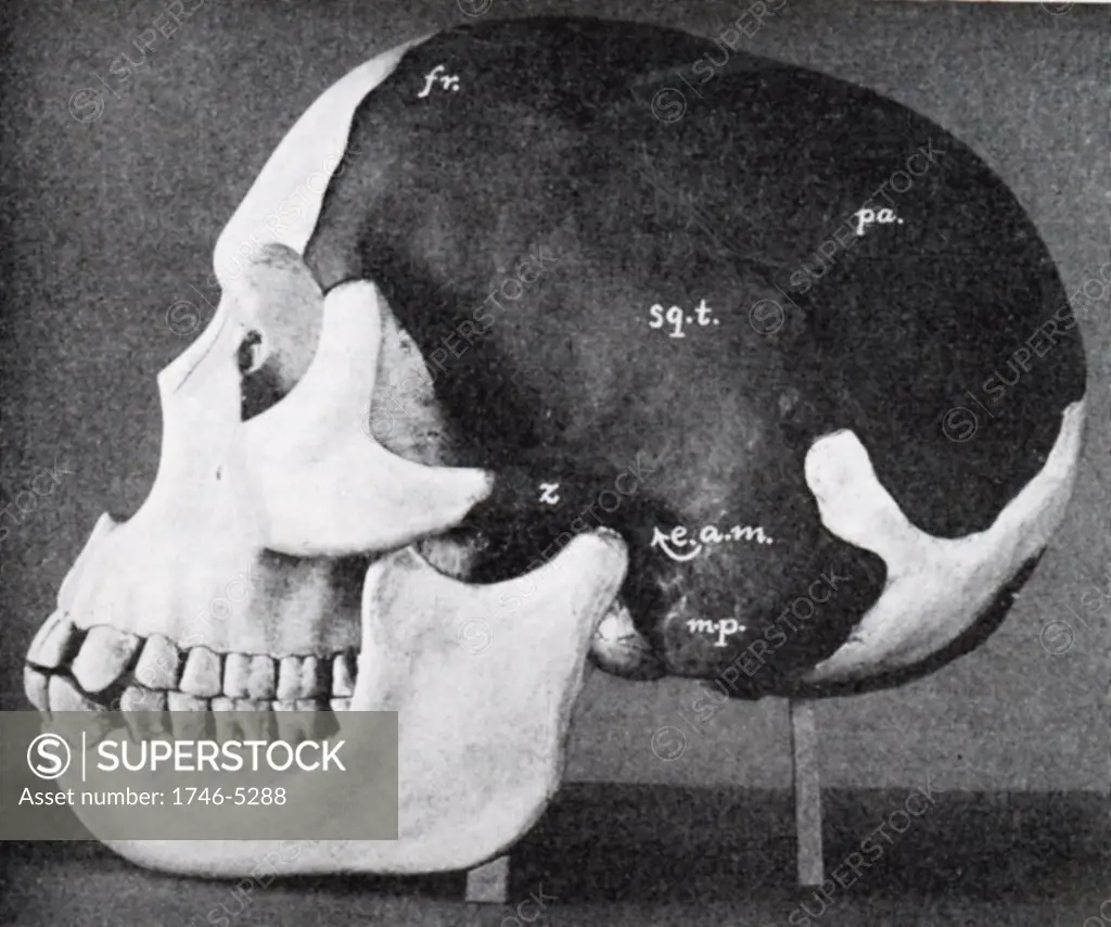 Model of skull of Piltdown man (Eanothropus dawsoni) as reconstructed by Dr Smith Woodward. Dark areas are from the original fossil, the light are the restored areas. Most of the lower jaw restored on far side. From Scientific American 7 November 1914.