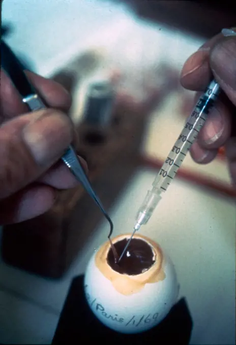 Analysing Influenza virus at a World Health Organisation facility 1980's