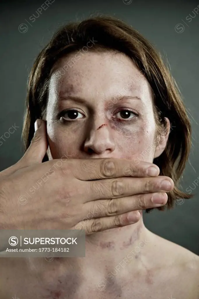 Woman with bruises and mouth covered
