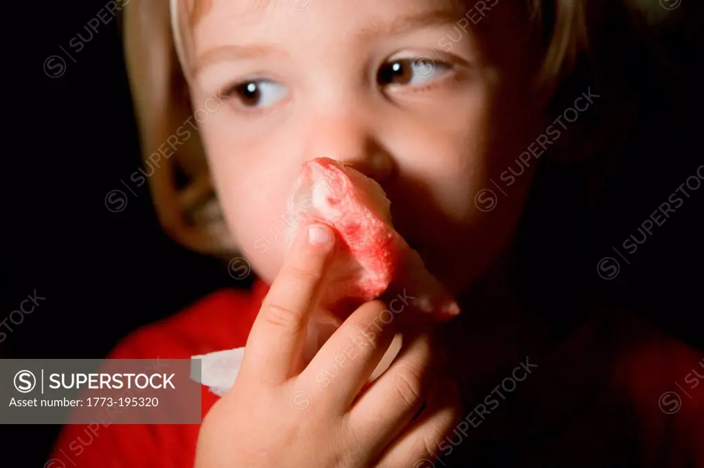 Boy holding blood stained tissue paper over nose